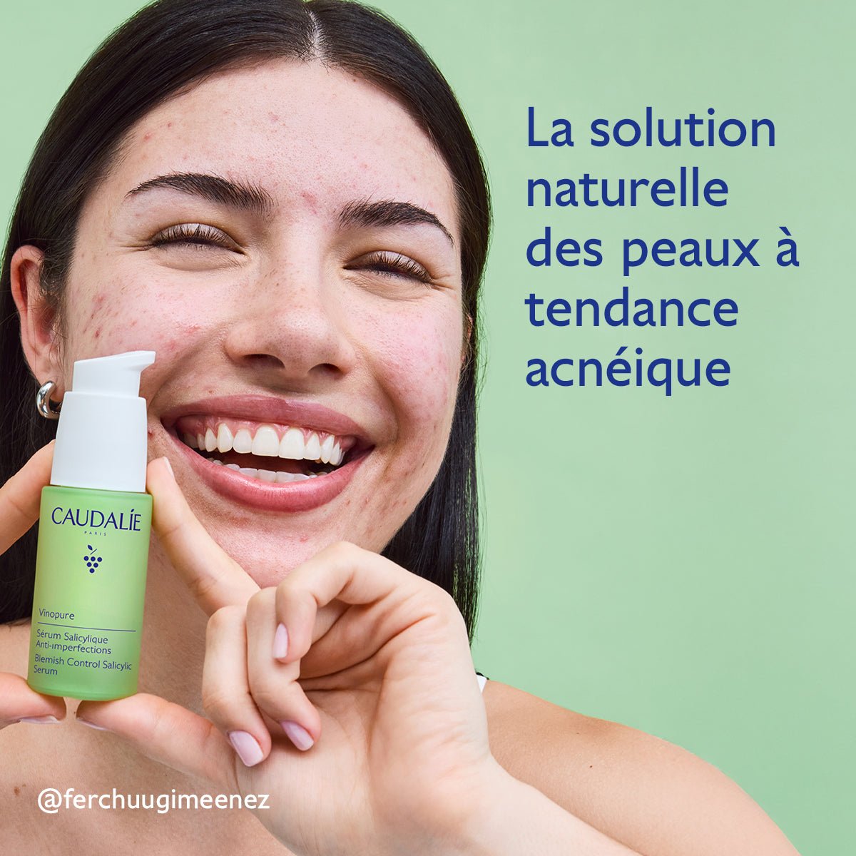 Caudalie Vinopure Sérum Salicylique Anti - Imperfections 30ml - La Grande Para