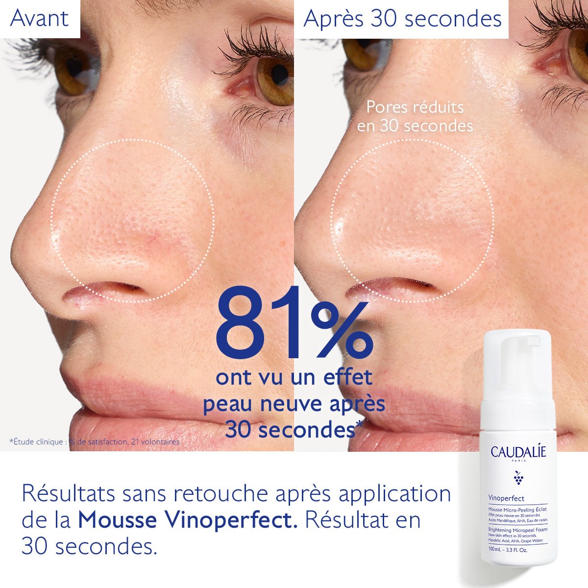 Caudalie Vinoperfect Mousse Micro - Peeling Éclat 100ml - La Grande Para