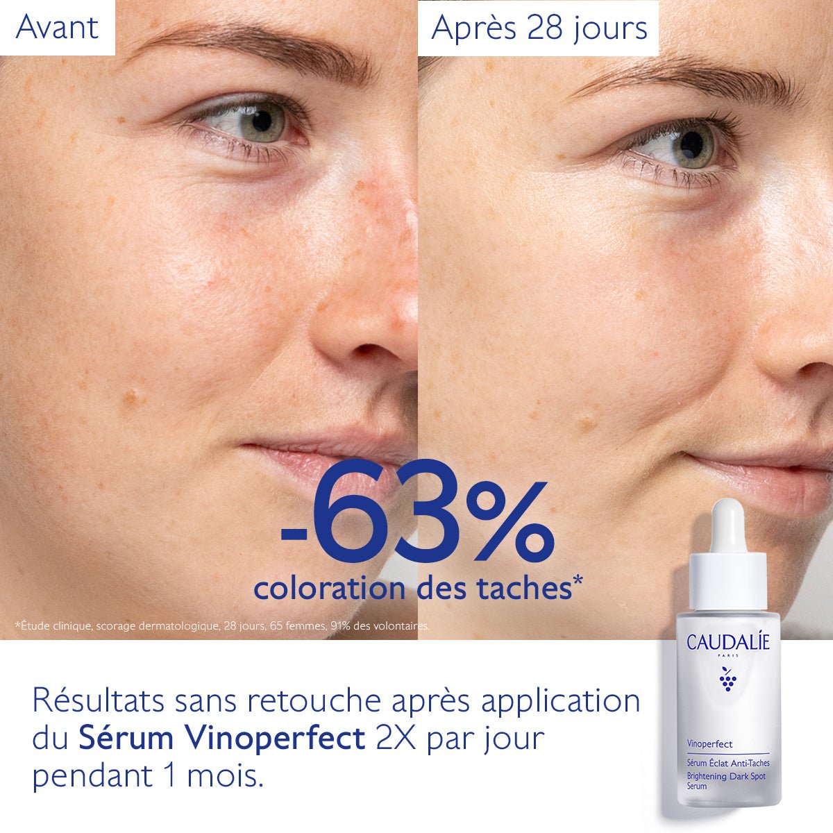 Caudalie Vinoperfect Sérum Éclat Anti - Taches 30ml - La Grande Para
