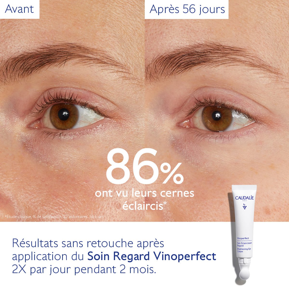 Caudalie Vinoperfect Soin Éclaircissant Regard 15ml - La Grande Para