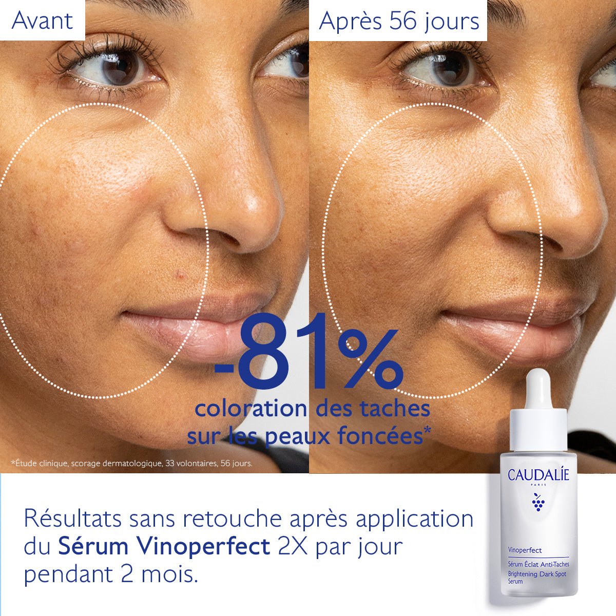 Caudalie Vinoperfect Sérum Éclat Anti - Taches 30ml - La Grande Para