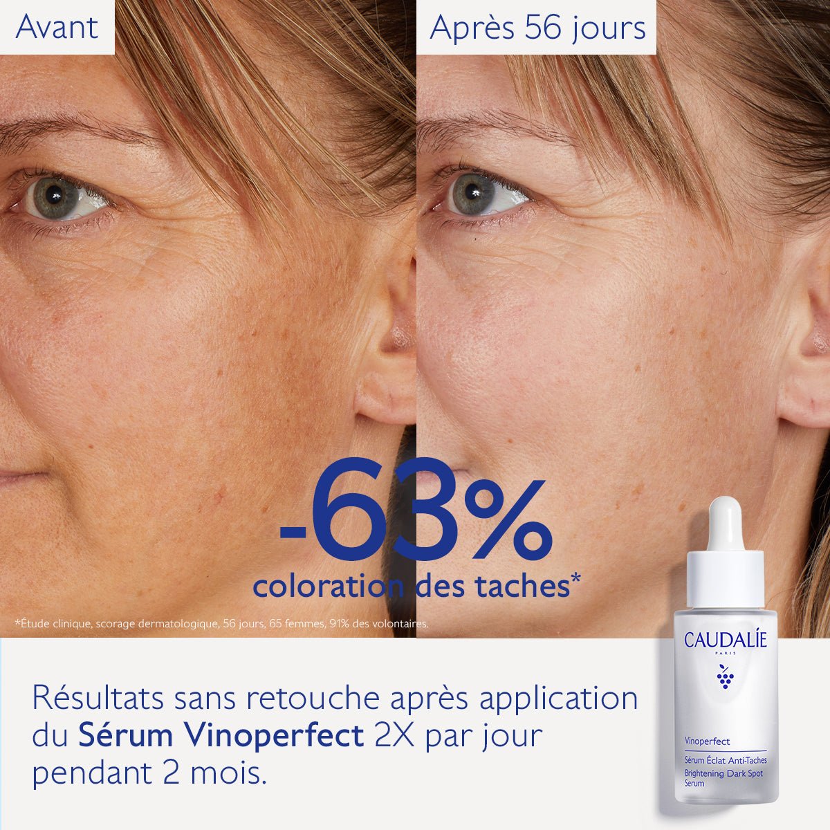 Caudalie Vinoperfect Sérum Éclat Anti - Taches 30ml - La Grande Para