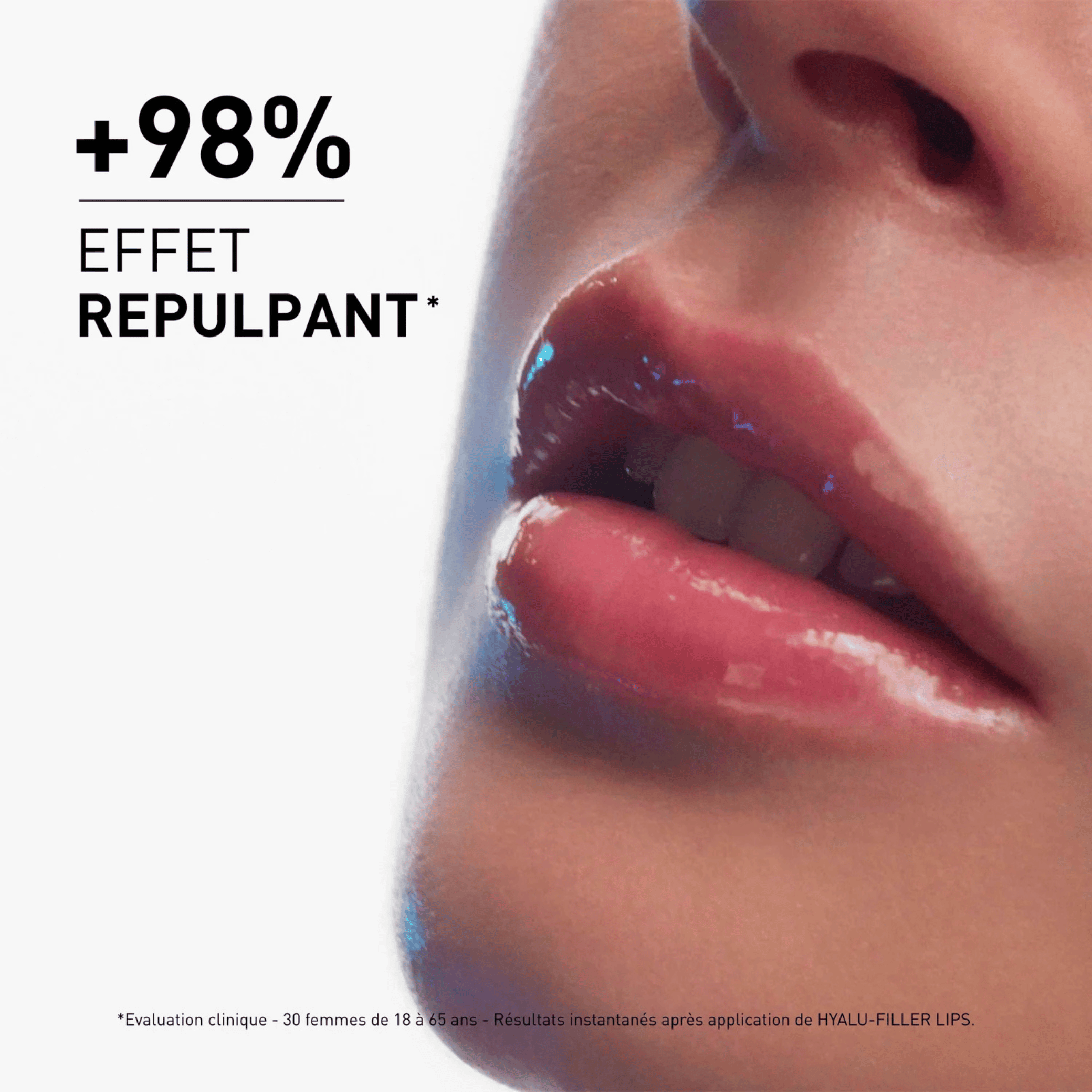 Filorga Hyalu - Filler Lips Soin Lèvres Volumateur 4g - Baume Repulpant Acide Hyaluronique - La Grande Para